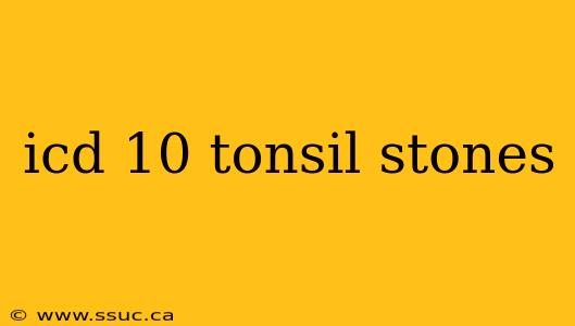 icd 10 tonsil stones