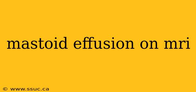 mastoid effusion on mri