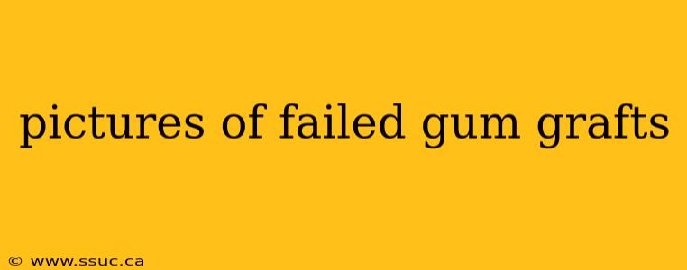 pictures of failed gum grafts