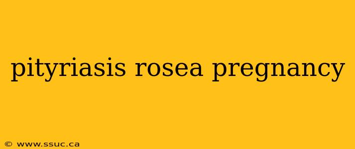 pityriasis rosea pregnancy