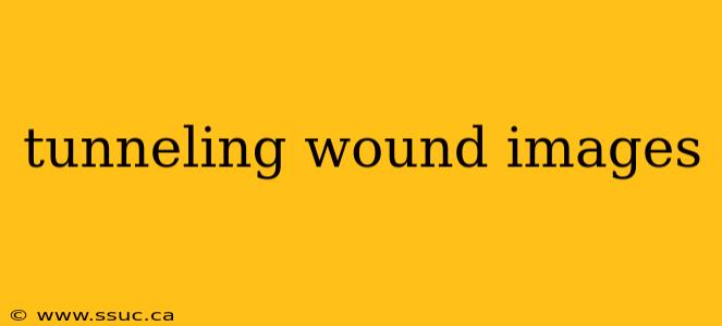 tunneling wound images